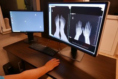 Zdjęcie z dużym monitorem LCD pokazującym dwa zdjęcia rentgenowskie - stóp i dłoni.